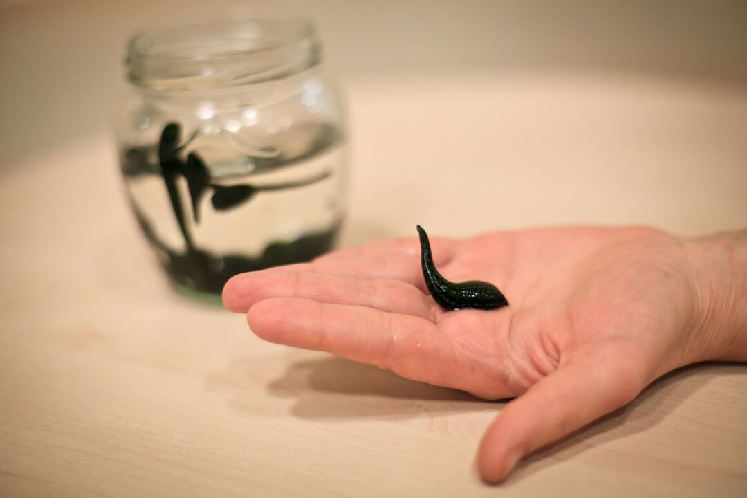 Leeches នឹង​បម្រើ​ជា​វត្ថុធាតុ​ដើម​សម្រាប់​ផលិត​ក្រែម​ដែល​ជំរុញ​ដល់​ការលូតលាស់​លិង្គ